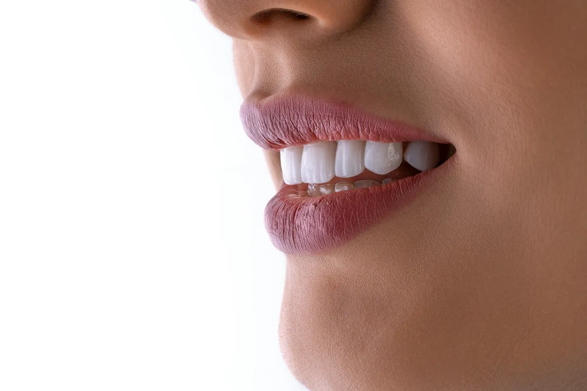 Sorriso em close, com dentes alinhados e claros