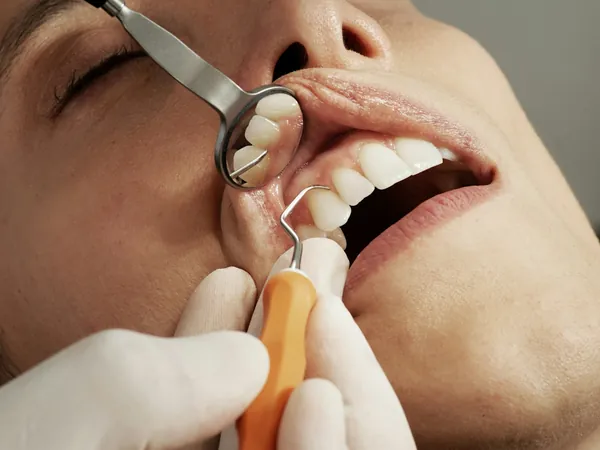 Avaliação odontológica com espelho clínico